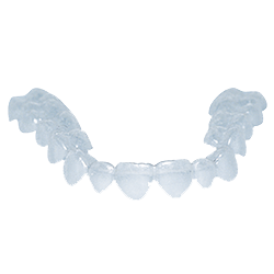 Schienenbehandlung Clear Aligner